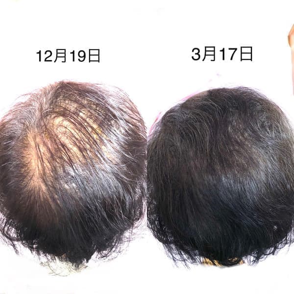 超 発毛メソッド For women.の比較画像
